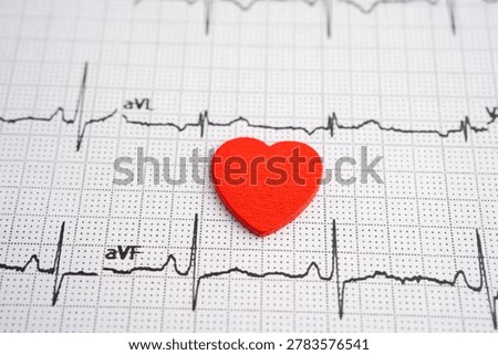 Electrocardiogram ECG, heart wave, heart attack, cardiogram report.