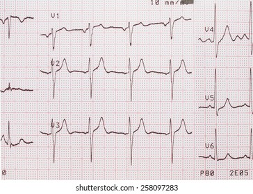 Electrocardiogram, ECG Printout, EKG Background