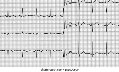 Elektrokardiogramm Images, Stock Photos & Vectors | Shutterstock