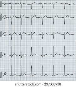 Electrocardiography Aka Ekg Elektrokardiogramm Measure Heartbeat Stock ...