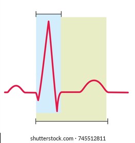 normal ecg images stock photos vectors shutterstock ekg charts