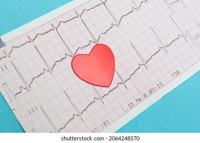 Electrocardiography ECG. Heart lies on the cardiogram. Caring for the health of the heart. Blue background. Medical research. Close-up.