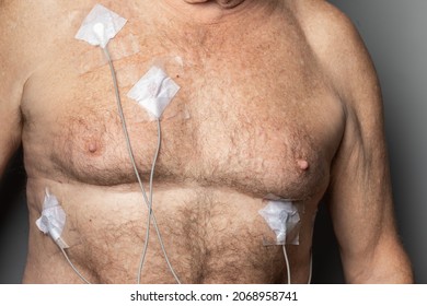 Electrocardiography ECG Leads For A Portable Heart Monitor On An Elderly Male Patient