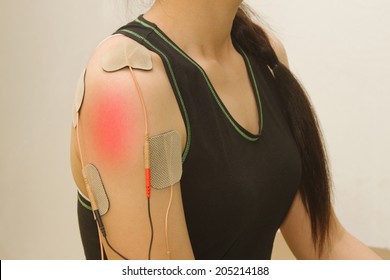 Electrodes  device on shoulder, transcutaneous interferential electrical stimulation( TENS ) therapy  for pain management.