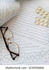   Electroencephalogram (EEG) Of The Patient Confirming Epilepsy                             