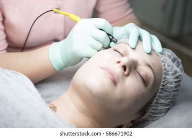 Electrolysis Hair Removal