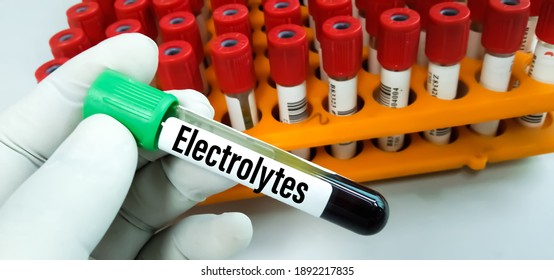 480 Electrolyte Test Images, Stock Photos & Vectors | Shutterstock