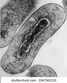 Electron Micrograph Cross Section Of Escherichia Coli Bacteria