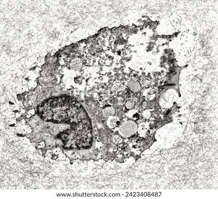 Electron microscope micrograph showing a dying chondrocyte of the calcification zone of the growth plate. The plasma membrane has broken and the cytoplasmic organelles are being destroyed.