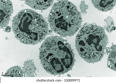 Electron Microscopy Photography of a group of human Neutrophils.