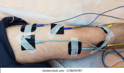 Electrostimulation of the quadriceps as a physiotherapy therapy 