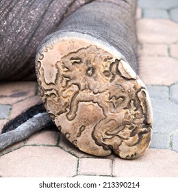 Elephant Foot