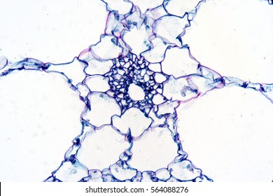 Eloden (Elodea Canadensis) Section Under The Microscope