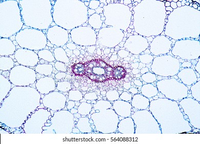 Eloden (Elodea Canadensis) Section Under The Microscope