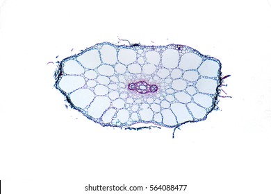 Eloden (Elodea Canadensis) Section Under The Microscope