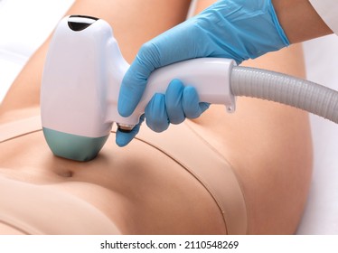 Elos Epilation Hair Removal Procedure On A Woman’s Body. Beautician Doing Laser Rejuvenation On The Lower Leg In A Beauty Salon. Removing Unwanted Body Hair. Hardware Ipl Cosmetology