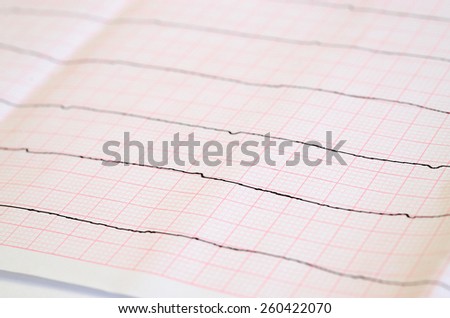 Emergency cardiology. Tape ECG with ventricular asystole
