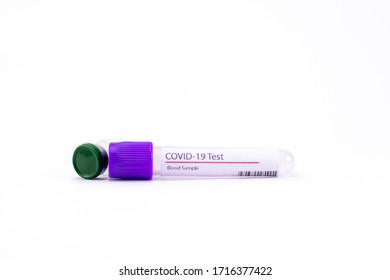 An Empty COVID 19 Blood Test Kit With A Vial On White Background