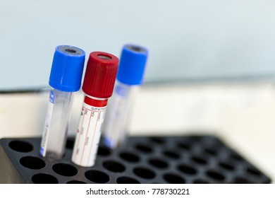 Lot Of Empty Laboratory Blood Analysis Tubes At Medical Center.