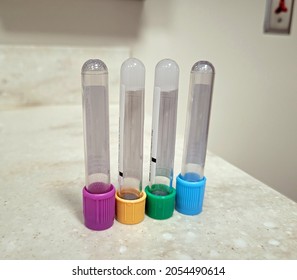 Empty Multicolored Lab Blood Tubes On Countertop In Lab, Hospital Setting