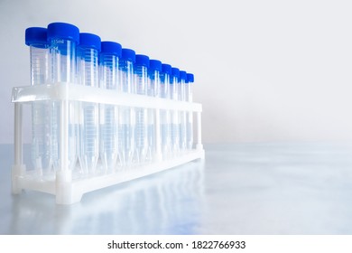 Empty plastic test tubes on table. Disposable medical utensils. Disposable blood test tubes. Labware for analyzes. Place for an inscription. Medical concept. Plastic test tubes on light background.