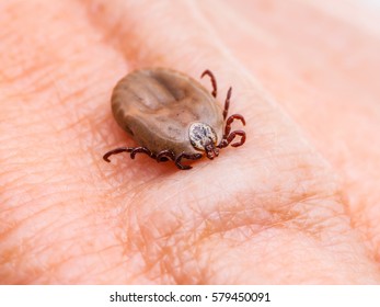 Encephalitis TIck Insect On Skin Macro Close-up