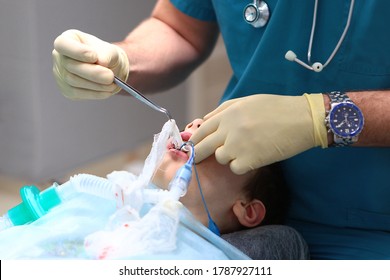 The End Of The Operation. The Child Is Taken Out Of Anesthesia. The Removal Of The Breathing Tube. Concept Of Health Care And Life Saving. Copy Space. An Unrecognizable Photo.