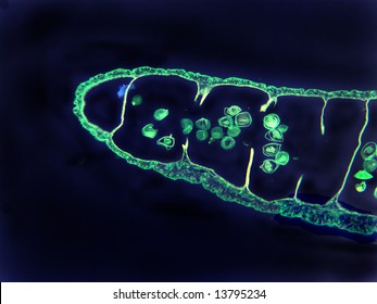 The end portion of a proglottid (segment) cross section microscopic of a parasitic tapeworm (Taenia).  The ova (eggs) can be seen within the proglottid sections