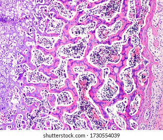 endochondral bone formation histology