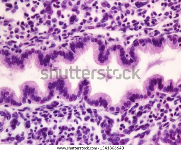 Endometrial Gland Secretory Phase Uterine Cycle Stock Photo 1541866640 ...