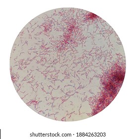 endospores under microscope