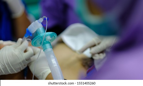 Endotracheal tube on a patient undergoing Procedure of Surgery. 