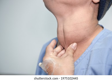 Enlarged multinodular thyroid goiter in middle-aged Asian female.By being healed in the hospital To get a goiter surgery soon