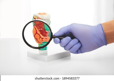 Enlarged Thyroid Gland, Diffuse Toxic Goiter Disease. Endocrine Autoimmune Diseases