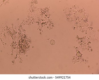 entamoeba coli Stock Photo