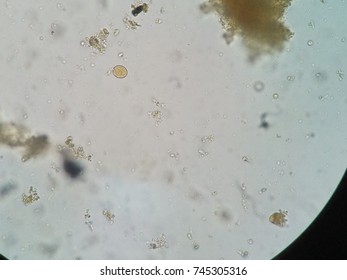 Entamoeba coli cyst (iodine) Stock Photo