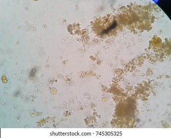 Entamoeba coli cyst (iodine) Stock Photo