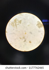 Entamoeba coli cyst stage in light microscope Stock Photo