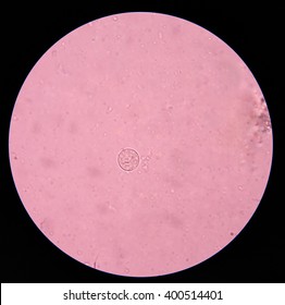 entamoeba coli cyts potozoa  in stool exam. Stock Photo