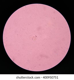 entamoeba coli cyts potozoa  in stool exam. Stock Photo