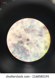 Entamoeba coli in light microscope Stock Photo