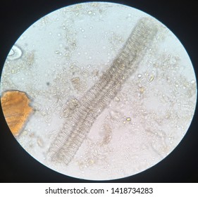 Entamoeba coli is a non-pathogenic species of Entamoeba that frequently exists as a commensal parasite in the human gastrointestinal tract. Stock Photo