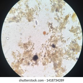 Entamoeba coli is a non-pathogenic species of Entamoeba that frequently exists as a commensal parasite in the human gastrointestinal tract. Stock Photo