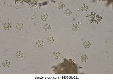 Entamoeba coli  protozao cystsstage in stool exam. Stock Photo