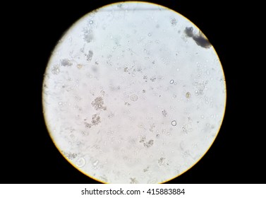 Entamoeba coli in stool under microscope Stock Photo