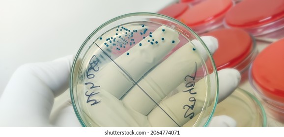 Enterobacter Colonies, GNR, Gram Negative Rods Colonies As Test On Chomogenic UTI Agar Plate.