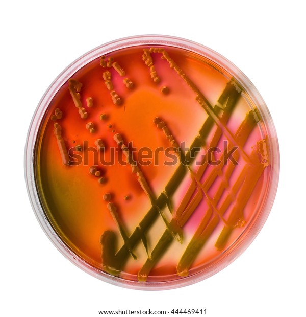 Enterobacteriacea Colonies On Hektoen Enteric Agar Stock Photo (Edit ...