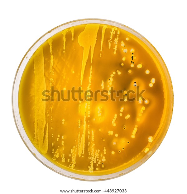 Enterobacteriacea Colonies On Xld Agar Petri Stock Photo (Edit Now ...