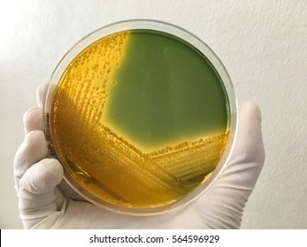 Enterobacteriaceae On TCBS  Agar