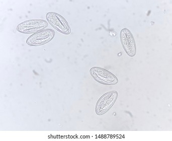 Enterobius vermicularis in stool. Paraziti helminth lamblia, Enterobius vermicularis ova in stool